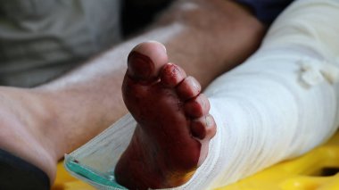Riots and injuries in the subway of Rio de Janeiro. January 20, 2023. Brazil, Rio de Janeiro: Injured passengers are evacuated by paramedics from the Estacio Metro station in Rio, in the central region of the city