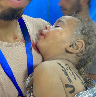 GAZA (PALESTINE) - 10 / 23 / 2023: İsrail savaş uçaklarının evlerine yönelik şiddetli ve ağır saldırıları sonrasında Gazze 'deki El-Şii Tıp Hastanesi' ne kaldırılan Filistinliler