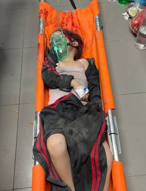 GAZA (PALESTINE) - 10 / 23 / 2023: İsrail savaş uçaklarının evlerine yönelik şiddetli ve ağır saldırıları sonrasında Gazze 'deki El-Şii Tıp Hastanesi' ne kaldırılan Filistinliler