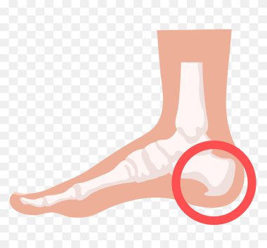 Topuk illüstrasyonu. Vektör illüstrasyonu şeffaf arkaplanda izole edildi.