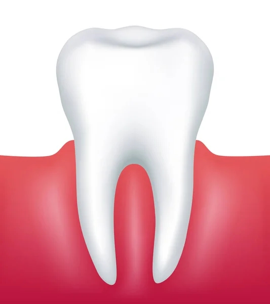Δόντι Τερηδόνα Απομονωμένο Διάνυσμα Λευκό Φόντο — Διανυσματικό Αρχείο