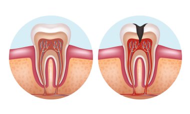 İnsan dişinin yapısı. Diş anatomisi. Vektör illüstrasyonu.