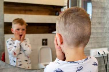 Doğal aşılama. Bulaşıcı bir hastalık. Suçiçeği hastası bir çocuk. Varicella virüsü ya da çocuk vücudunda ve yüzünde su çiçeği kabarcığı kızarıklığı. Yüksek kalite fotoğraf