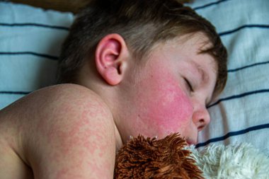 Yüksek telli parka tırmanan insanlar. Dağ miğferi ve güvenlik ekipmanları takan insanlar. Yüksek kalite fotoğraf. Yüksek kalite fotoğraf