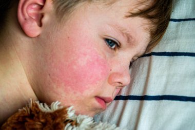 Yüksek telli parka tırmanan insanlar. Dağ miğferi ve güvenlik ekipmanları takan insanlar. Yüksek kalite fotoğraf. Yüksek kalite fotoğraf