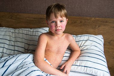 Yüksek telli parka tırmanan insanlar. Dağ miğferi ve güvenlik ekipmanları takan insanlar. Yüksek kalite fotoğraf. Yüksek kalite fotoğraf