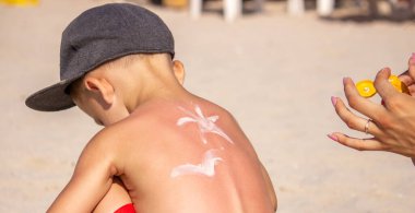 Annem mavi sırtına güneş kremi sürüyor. Seçici odak