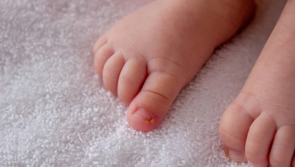 Bir Bebek Irin Bir Tırnak Parmağa Dönüştü Seçici Odak — Stok fotoğraf