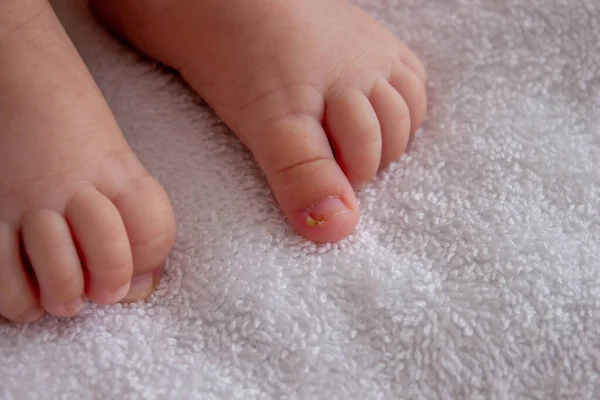 Bir Bebek Irin Bir Tırnak Parmağa Dönüştü Seçici Odak — Stok fotoğraf