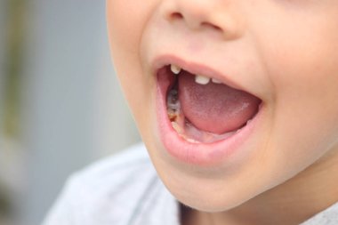 Dişsiz bir çocuk. Seçici odaklanma. Doğa