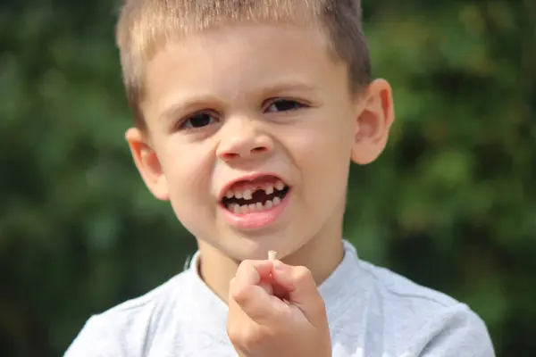 子供は歯を失った 選択的な焦点 キッド ベビー歯をコンセプト ストック画像