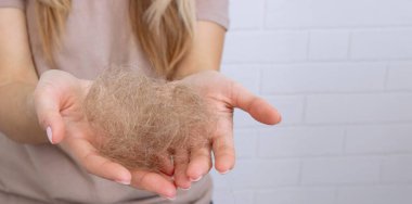 Kadının saçı dökülüyor. saç fırçası, saç dökülmesi.