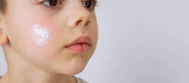 Çocuk kuru cilt için yüzüne krem sürüyor.