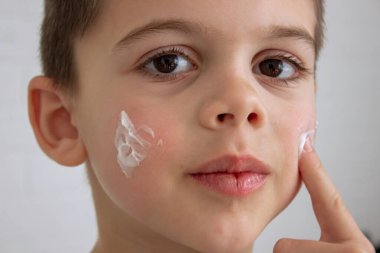 Çocuk kuru cilt için yüzüne krem sürüyor.