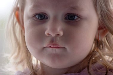 Küçük bir çocuğun yüzüne ve burnuna sümükle yakın çekim. Çocuklarda soğuk, akan burun, alerji.