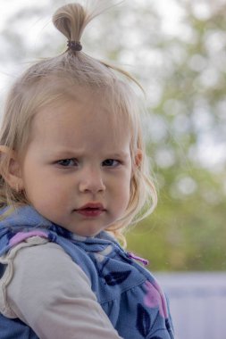 Küçük bir çocuğun yüzüne ve burnuna sümükle yakın çekim. Çocuklarda soğuk, akan burun, alerji..