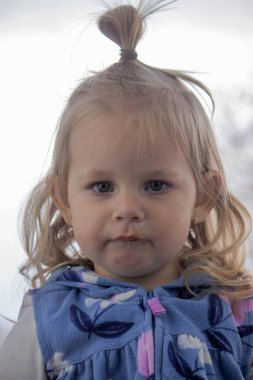 Küçük bir çocuğun yüzüne ve burnuna sümükle yakın çekim. Çocuklarda soğuk, akan burun, alerji..