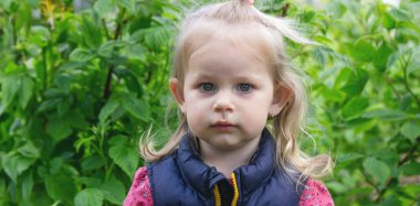 Küçük kızda sümük var. Bahar alerjisi.