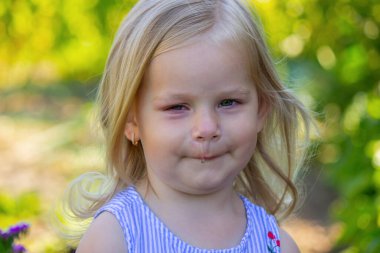 Kızın alerjisi var. Sümük