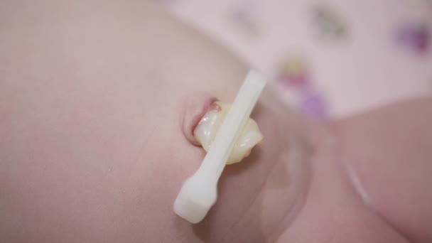 Navelsträngen Magen Hos Ett Nyfött Barn Omedelbart Efter Förlossningen Vit — Stockvideo