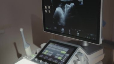 The doctors hand controls the ultrasound device. A 4D or 3D ultrasound of a 39 week gestational baby on a fetal ultrasound showing detail of her face. A pregnant woman undergoes a 4D ultrasound.
