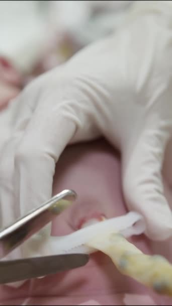 Vertical Video Hands Doctor White Gloves Cut Umbilical Cord Newborn — Stockvideo