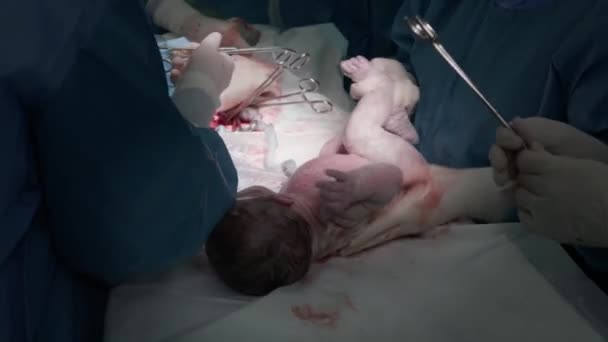 孩子是通过剖腹产分娩出来的 刚出生的孩子出生的几秒钟和几分钟后 产科医生用夹子把母亲的腹部缝起来 — 图库视频影像