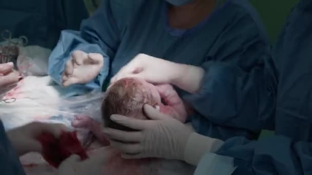 Medici Puliscono Bambino Immediatamente Dopo Taglio Cesareo Prendono Dal Tavolo — Video Stock