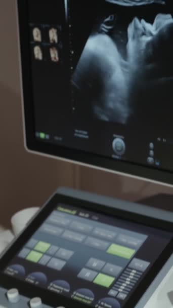 Pionowe Wideo Usg Lub Tygodnia Ciąży Lekarze Kontrolują Ultrasonograf Napis — Wideo stockowe