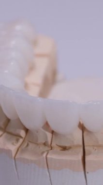 Dikey video. Diş kaplamalı yapay çene kalıbı, beyaz arka planda dönüyor. Diş protezi, yapay diş, protez. Diş implantları, modern dişçi teknolojisi..