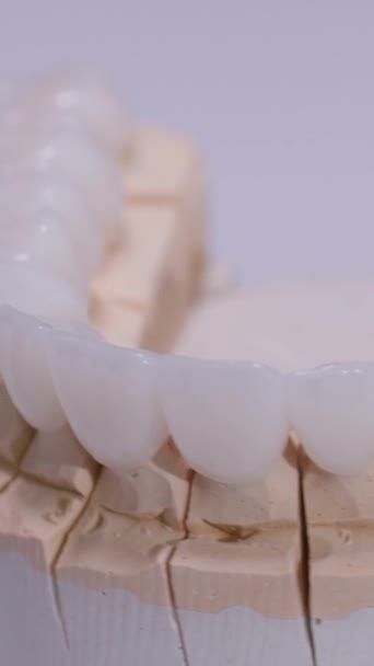 Вертикальне Відео Штучна Щелепа Зубними Коронками Обертаються Білому Тлі Стоматологічний — стокове відео