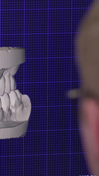 Lodret Video Program Computer Display Bruges Tandtekniker Til Gøre Protese – Stock-video