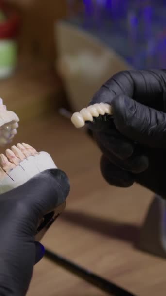 Videoclip Vertical Mâinile Unui Tehnician Dentar Mănuși Negre Instalează Implanturi — Videoclip de stoc