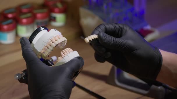 Aproape Mâinile Unui Tehnician Dentar Mănuși Negre Instalează Implanturi Ceramice — Videoclip de stoc