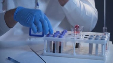 Laboratuvarda kan örnekleriyle çalışan bir patolog. Bilimadamı DNA örneğini laboratuvarda inceliyor. Sağlık sigortası, kan testi, kan araştırması. Laboratuvar çalışanı kan örnekleriyle slayt hazırlıyor.. 