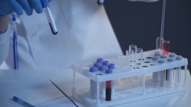 Laboratuvarda kan örneğiyle çalışan bir bilim adamı. Laboratuar analisti kan kaymasını analiz ediyor. Doktor ya da patolog cam levhaya insan kanı döker. Virüsü tanımlamak için biyolojik materyal.. 
