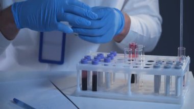 Klinik laboratuarında kan testi tüpleri olan bir sağlık görevlisi. Tıbbi tetkikçiler klinik araştırma laboratuvarında analiz için kan örneği tutuyorlar. Bilim merkezinde başlayan hastalıkların önlenmesi