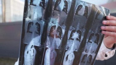 Genç beyaz doktor pulmonolog, pulmonoloji bölümüne teşhis koydu. COVID 19 salgını sırasında ilaç, sağlık ve sağlık sigortası konuları. Akciğer iltihabı Cronovirüs enfeksiyonu.