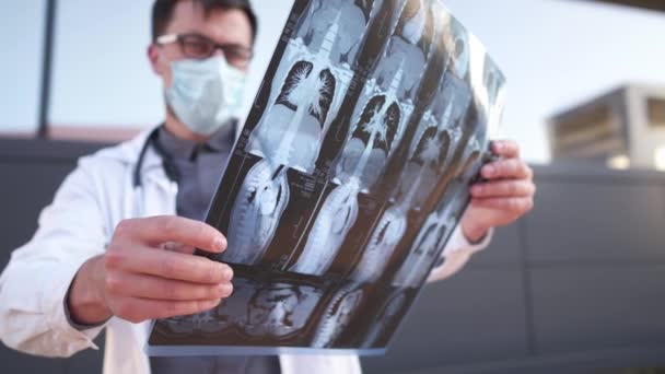 Exame Diagnóstico Por Tomografia Computadorizada Doenças Pulmonares Como Pneumonia Tubeculose — Vídeo de Stock