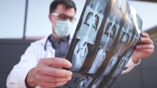 Erkek Doktor Hastanın Göğüs Röntgenini Tomografi Filmiyle Inceliyor Covid Vücut — Stok video