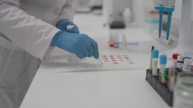 Center for lifeblood donation. Blood transfusion clinic. Plasma donation. Blood type and rh factor testing by agglutination method. Plastic blood palette in process HIV testing by agglutination method