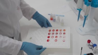Can damarı bağışı merkezi. Kan nakli kliniği. Plazma bağışı. Glutinasyon yöntemiyle kan grubu ve Rh faktörü testi. Toplama yöntemiyle HIV testinde plastik kan paleti