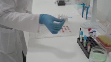 Laboratory determination of blood type. Blood test. Female laboratory assistant makes blood test, blood samples placed in cells on chart to determine the group and Rh factor. Recipient and donor. 