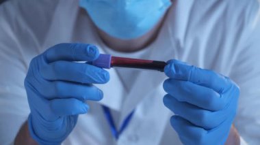 Hekimler üzerinde Coronavirus COVID-19 yazan ve üzerinde kan olan test tüpünü tutuyorlar. 2019-nCoV Coronavirus. Doktorların elinde eldivenli kan örneği bulundu. Reseach laboratuvarında analiz ediliyor.