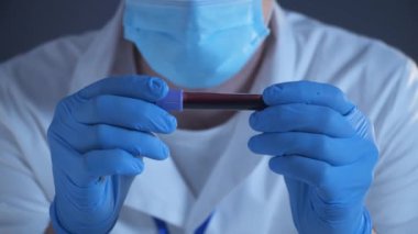 Doktor 2019 nCoV analizi için test tüpünü kanla tutuyor. Coronavirus hastalığı COVID-19 salgını. Sağlık sigortası konsepti, virüs testi. Nüfusun covid 19 'a bağışıklığı var mı diye kontrol ediliyor.