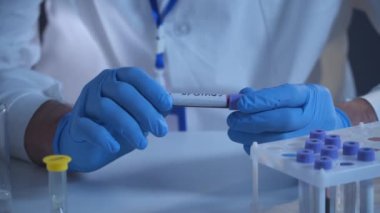 Doktor 2019 nCoV analizi için test tüpünü kanla tutuyor. Coronavirus hastalığı COVID-19 salgını. Sağlık sigortası konsepti, virüs testi. Nüfusun covid 19 'a bağışıklığı var mı diye kontrol ediliyor.