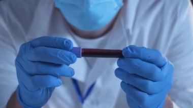 Kafkasyalı genç bir bilim adamı üzerinde Coronavirus hastasının antikorları olan bir kan örneğinin bulunduğu bir test tüpü tutuyor. Corona virüsüne karşı aşı arayışında olan bir laboratuarda doktor..