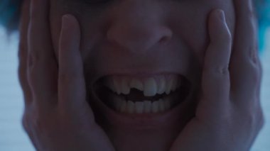 Yaralı dişli kadın acil serviste hastane kıyafetlerinde ağlıyor. Kırık dişli bir kadın klinikte ağlıyor. Hastanedeki kadın kazazede korkmuş ve histerik. Diş travması. 