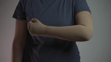 Varis, lenf iltihabı, eklem iltihabı, tenis dirseği, trombofil ve trombofil iltihabını desteklemek için sıkıştırma kolu. Klinik örgüler. Sıkıştırılmış çorap. Ameliyattan sonra tromboza karşı terapi. 
