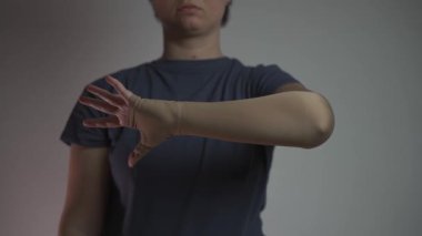 Sıkıştırma kolu. Sıkıştırılmış çorap ürünleri. Varisli damarların, trombozun, trombofil iltihabının ve venöz terapinin kol tedavisi için tıbbi çoraplar. Klinik örgü giysileri. Lympedema, Artrit. 